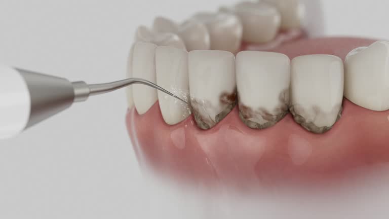 Trusted Emergency Dentist service in Merchantville, NJ - Dentist Open Now